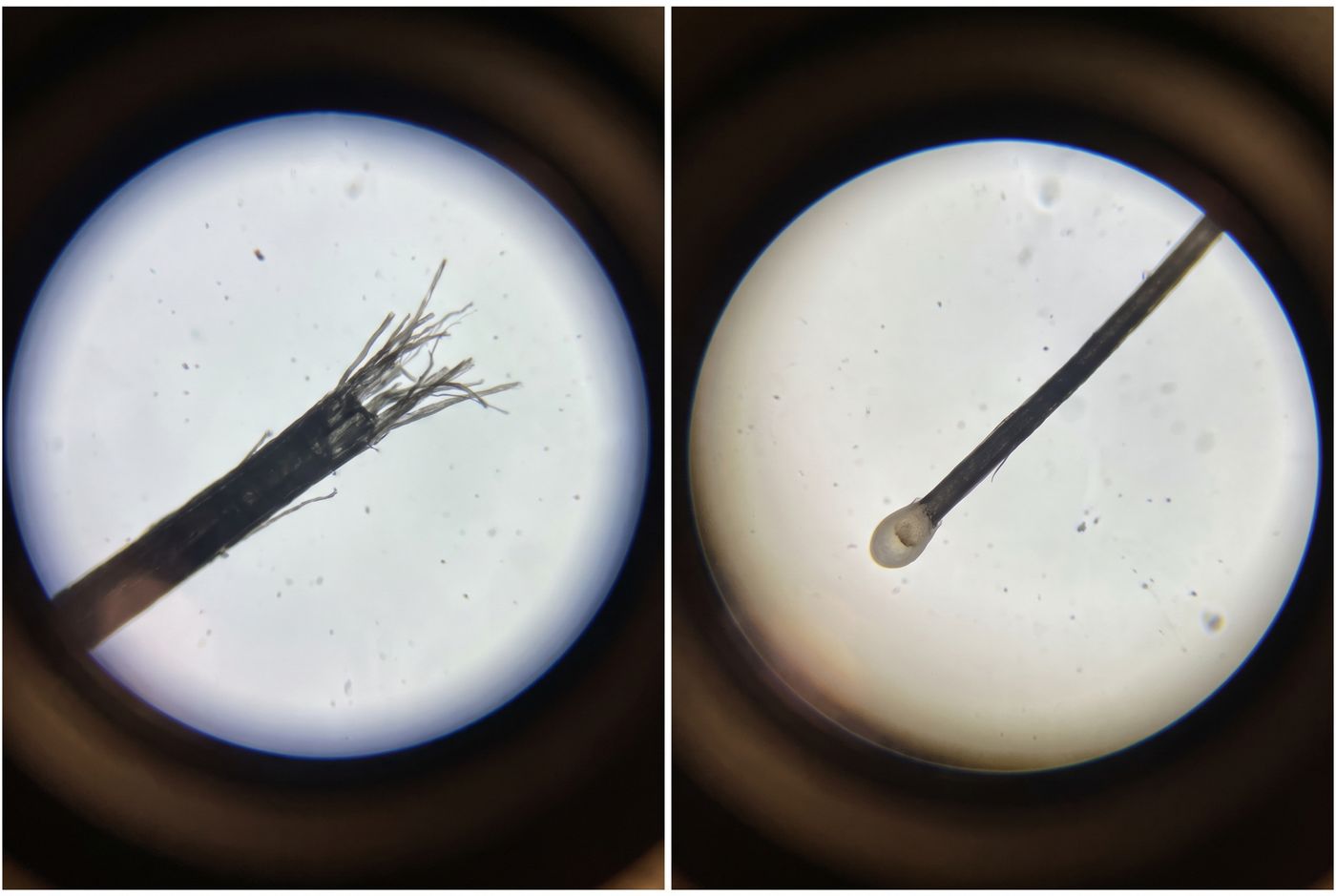 Two hairs under a microscope: one snapped with a frayed end, one fell out with a white root bulb